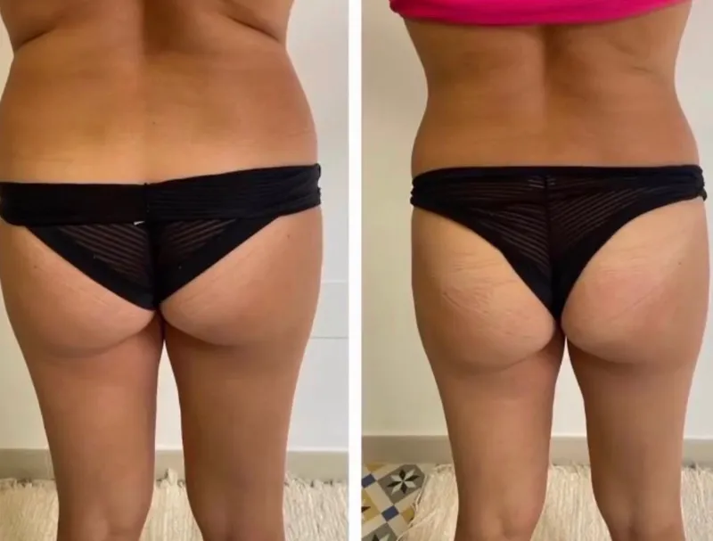 Glutes results